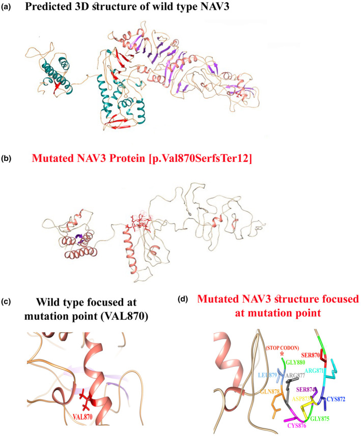 Breaking Discovery: NAV3 Gene Linked to a Novel Neurodevelopmental Disorder (NEDUA) – OMIM #621182